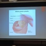 Spotkanie z Sanepidem - Rak piersi i wirus HPV